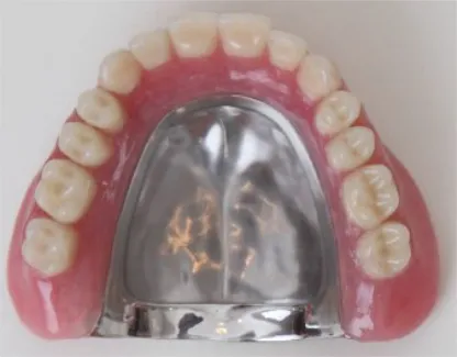 コバルト床の入れ歯画像
