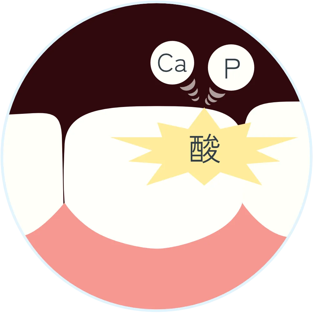 酸によって歯からカルシウムとリンが溶け出ているイラスト