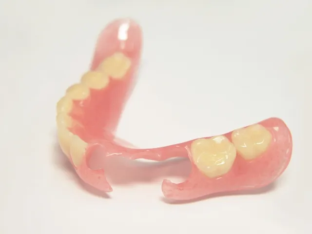金属を使用していない入れ歯の画像